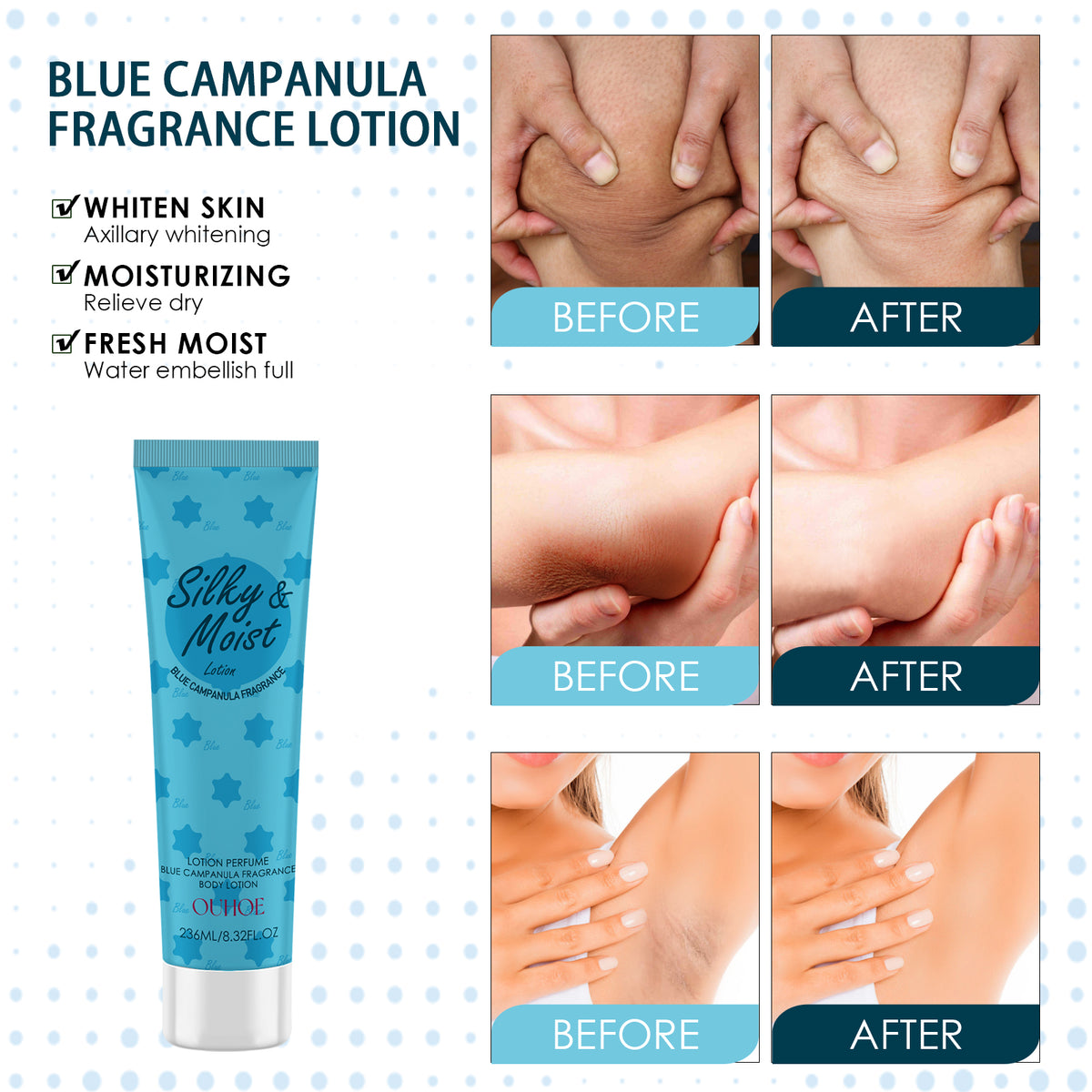 OUHOE Body Toner Lightening Armpit Knee Joint Dark Moisturizing Skin Whitening Body Beauty Care