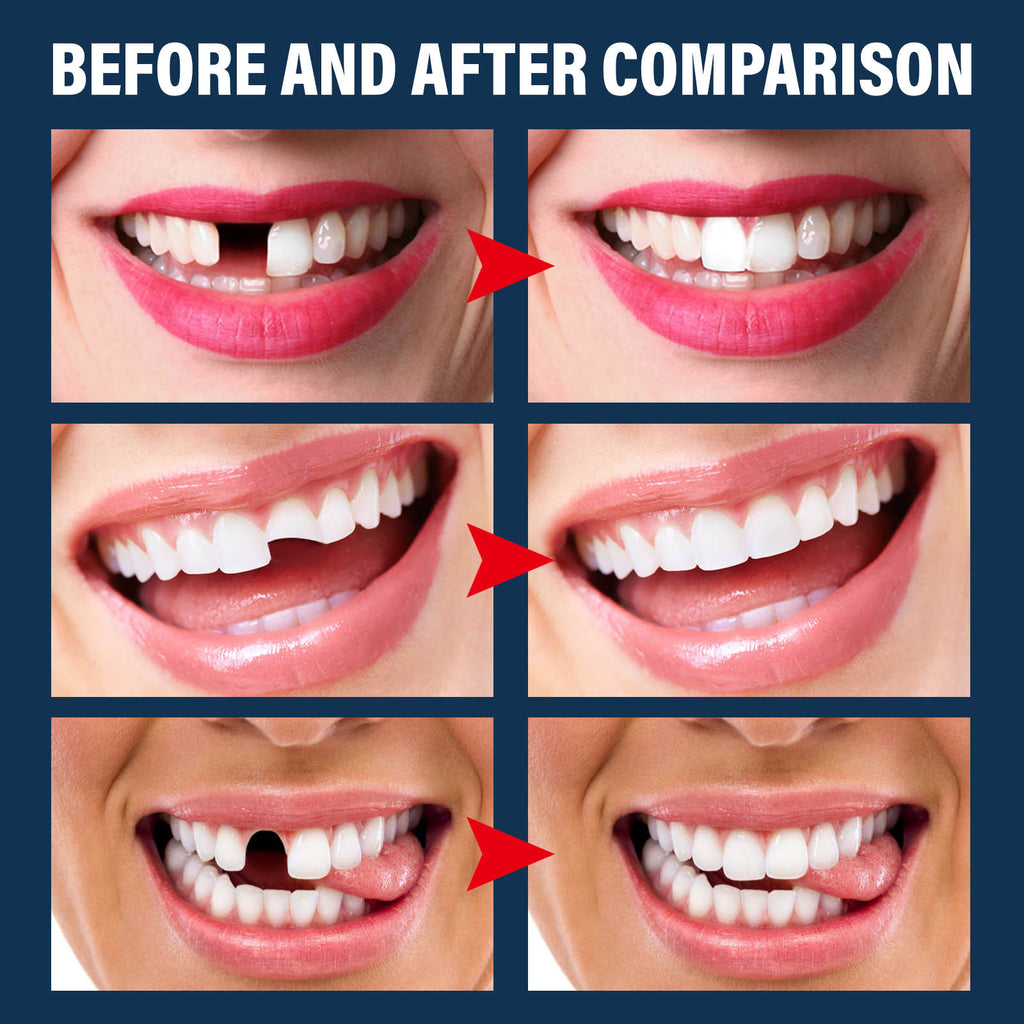 Quick Tooth Fix