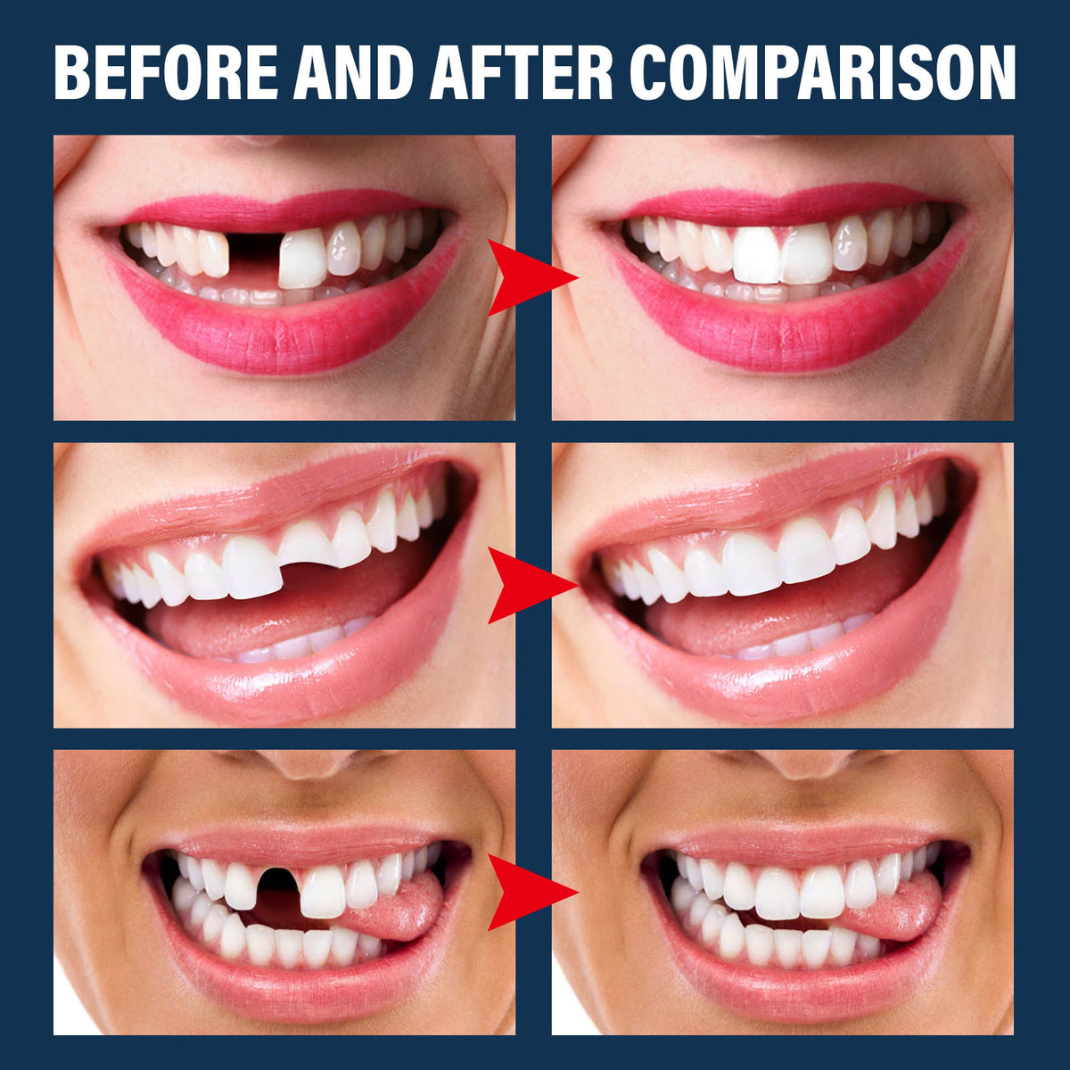 Quick Tooth Fix